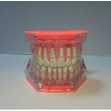 Transparent Abgedecktes Kiefer Modell